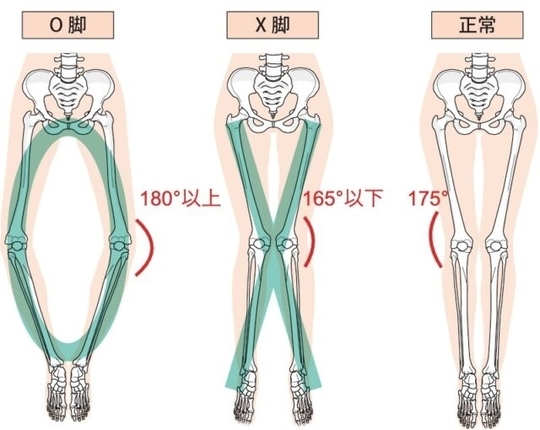 O脚X脚の解消、お任せ下さい！昭島市【腰痛専門整体室・欣令】